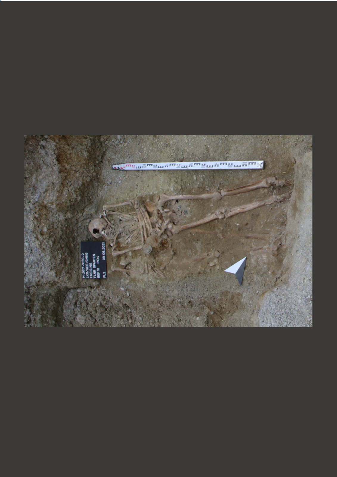Das freigelegte Skelett: an der linken Hand ist als Klumpen die Handprothese zu erkennen